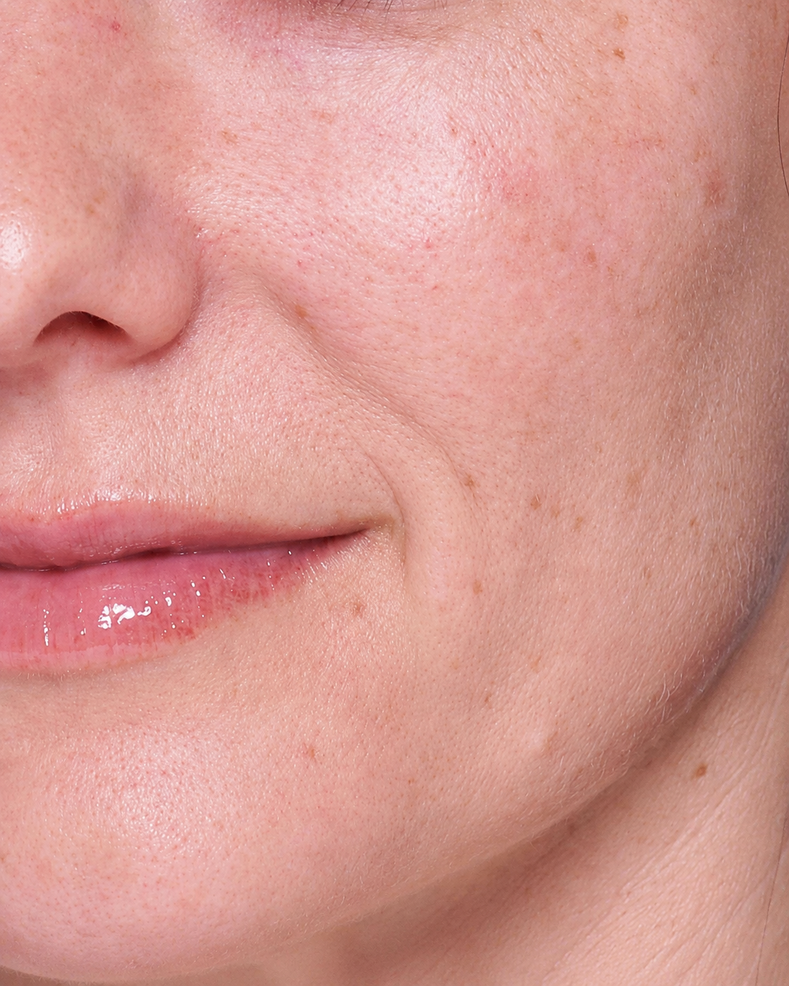 Skin appearance before, example two
