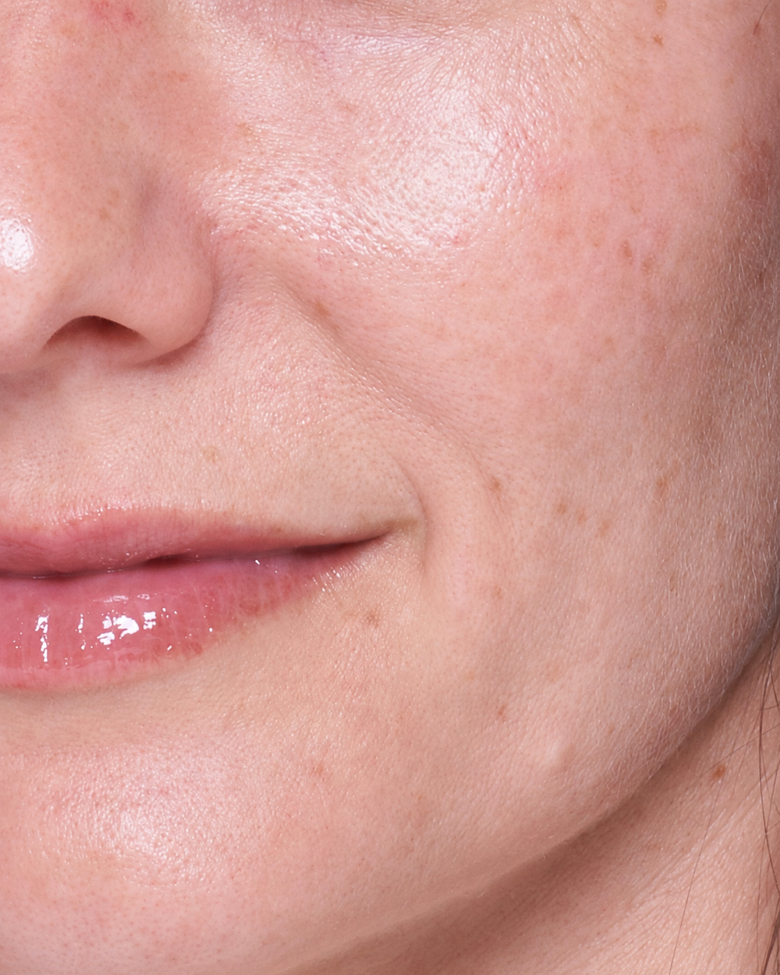 Skin appearance after, example two